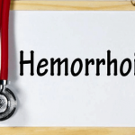 ¿Cómo saber si tengo Hemorroides en el Embarazo?